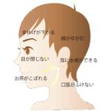 顔面神経麻痺に必要なこと