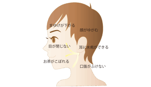 顔面神経麻痺に必要なこと