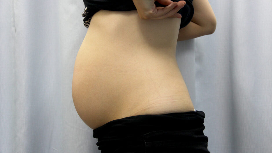 逆子体操をしたけど治らなかった