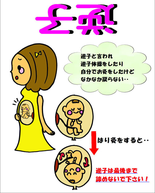 逆子が回っていました！